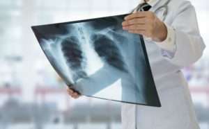 doctor examining x ray